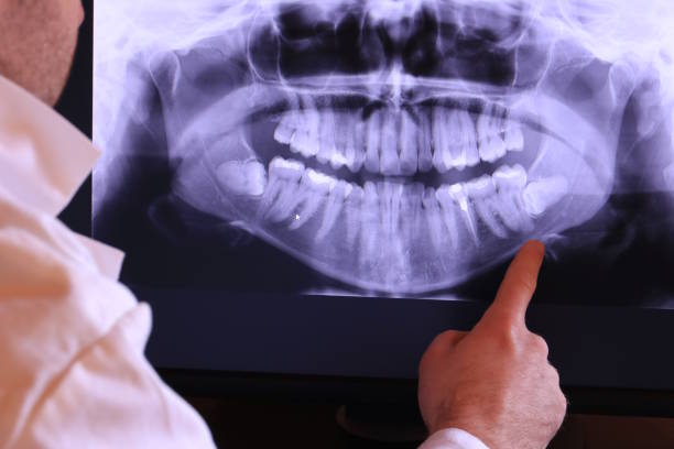 Best Emergency Dental Services for Seniors in Floris, VA