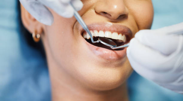 Best Emergency Dental Extractions in Floris, VA